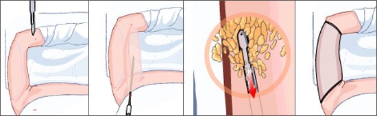 wms倉(cāng)庫(kù)管理系統(tǒng)